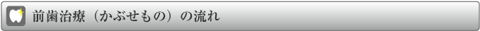 前歯治療（かぶせもの）の流れ